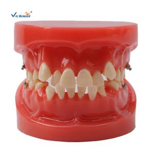 China Orthodontic Dental Study Models Tooth Teaching , Dental Models For Patient Education factory