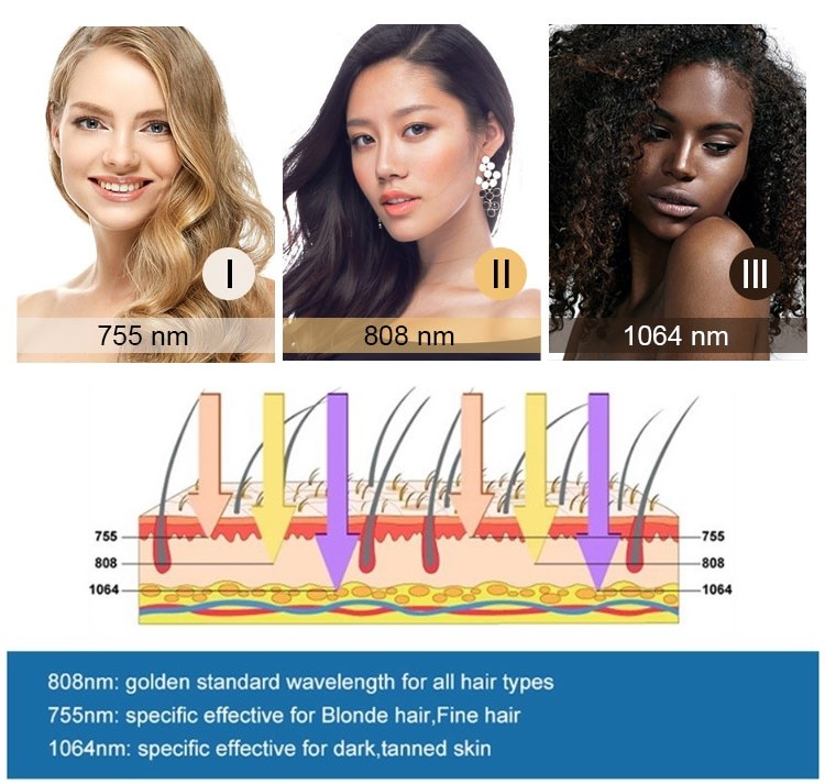 Professional Diode Laser Hair Removal Device - Smooth And Perfect Care For Your Skin