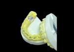 Long-lasting Function Durable Full Metal Cast Crown for Superior Tooth