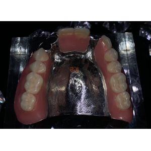 Openresty Server Software Based Metal Framework Partial Dentures Featuring
