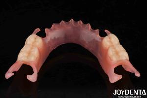 China Comfortable Fit Dental Flexible Denture Finish With High Stealth Diverse Materials factory