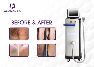 China Micro Channel 808 400ms Diode Laser Hair Removal Machine factory