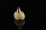 titanium 10mm Single Tooth Dental Implants Replacement Abutment Self Tapping