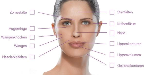 Ultra Deep Line TOPQ Injectable Hyaluronic Acid Filler Face Wrinkle / Nasolabial