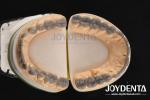 Natural Color Dental Wax Up Versatile Solution for Single or Multiple Teeth