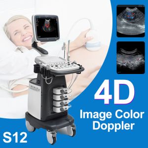 Sonoscape S12 Trolley Color Doppler System Digital Color Doppler Ultrasound