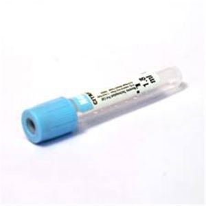 China Blue Top Sst Lab Test Serum Gel Tube Edta Vial EOS Disinfecting on sale