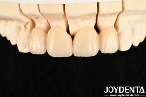 China High Translucency Layered Zirconia 3 W/mK Thermal Conductivity For Exceptional Performance factory