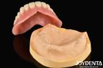 Good Elasticity Acrylic Denture Finish Diverse Tooth Arrangement Technology For