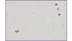 20Tests Semen Leukocytes Peroxidase Stain Kit Toluidine Method