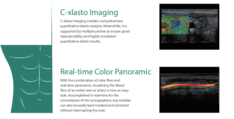 Sonoscape Portable Color Doppler Ultrasound Sonoscape S22 Ultrasound Machine Sonoscape P20 Doppler Ultrasound
