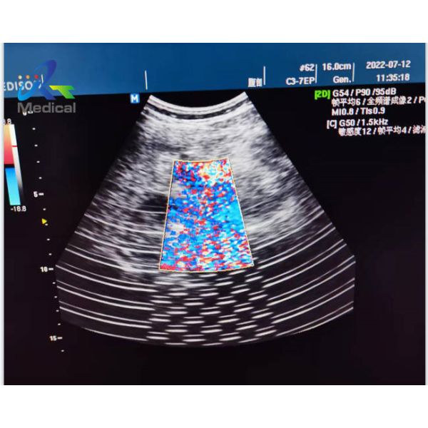 China Medison X6 Ultrasonic Board Repair Solutions Image Interference factory