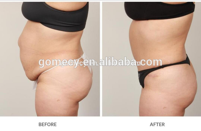 fat results