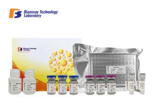 China Strong Sensitivity Human ELISA Assay Kit Sphingosine 1 Phosphate Receptor 3 96 Wells Size factory