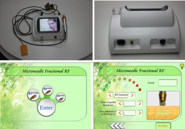 China supplier high quality wrinkle removal micro needle rf fractional beauty