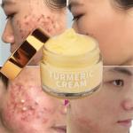 Organic Skin Care Acne Wrinkle Dark Spot Moisturizer Bleaching Turmeric Face