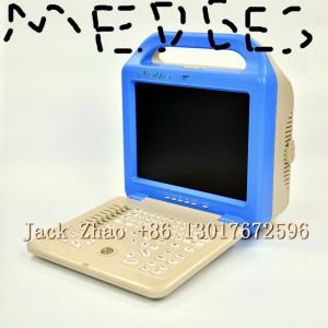 China Medbes Portable Ultrasound Machine for Human Being factory