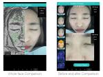 Skin Clinic Facial Skin Analyzer Essential Skin Detection Equipment