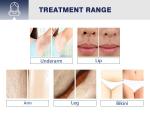 2021 Diode Laser Bikini Hair Removal 808 Diode Laser 755 808 1064 Ice Platinum