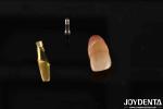 0° Angulation Finished Dental Abutments 1.5mm Thread Pitch Polished Surface