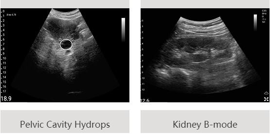 Compact Digital Portable Mobile Ultrasound Scanner Supported Andriod And Window