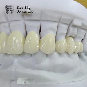 China Translucent Layered Zirconia Crown Dental Restoration Multilayer Zirconia Crown factory