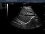 Full Digital Color Dopple Machine Portable Diagnostic Color Ultrasound Scanner