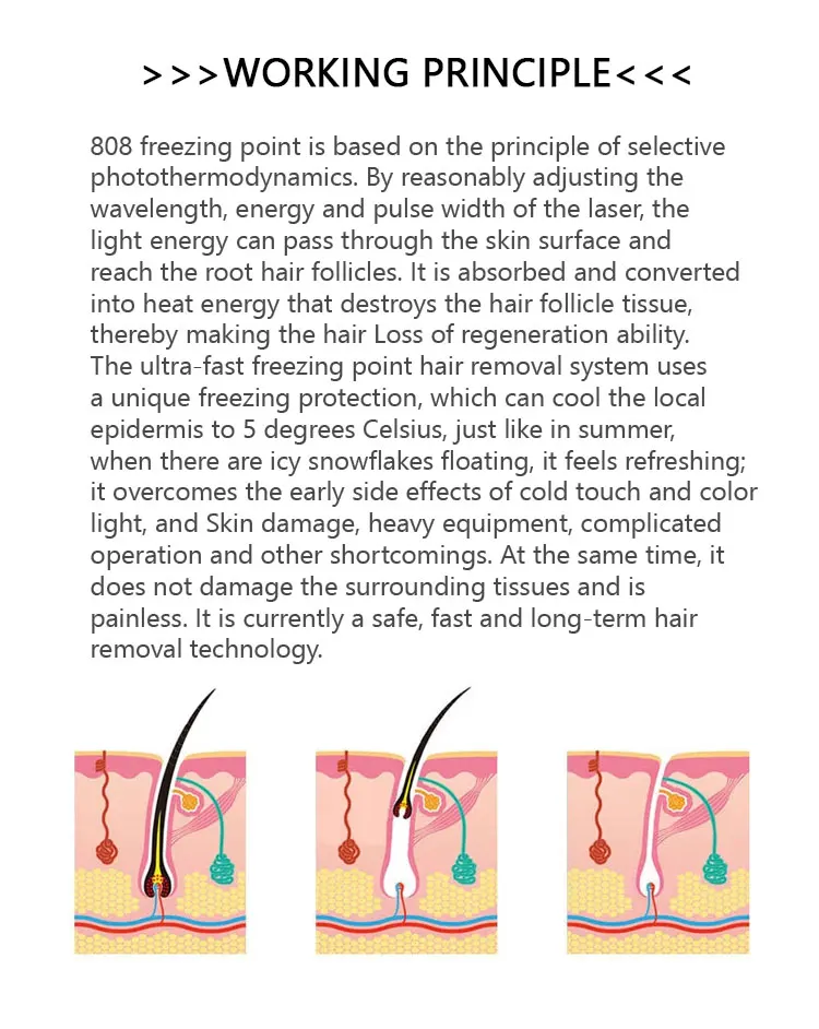 Laser Type Diode Laser Hair Removal Machine with 15*15mm Spot Size