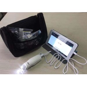 PAL Color System Vaginal Digital Electronic Colposcope Probe With AAA Batteries