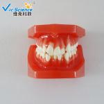 VIC-E8 Ortho Dental Study Models Malocclusions Classification 10 Pieces