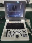 DICOM Portable 3D Ultrasound Machine Doppler Medical Instrument 64G