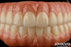 China Precise Fit Dental Ti-Bar Zirconia Hybrid Bridge Replacement For Missing Teeth factory