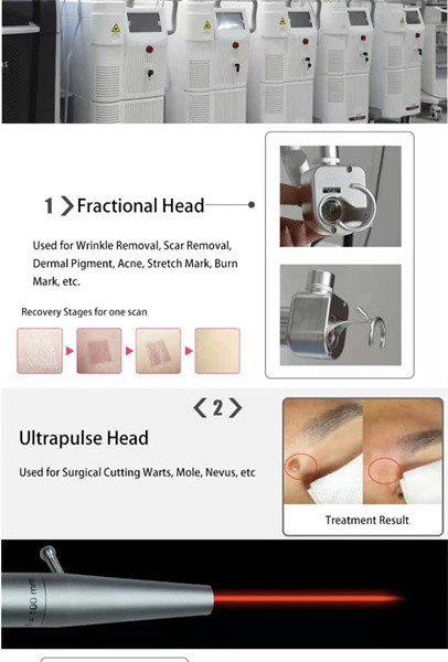 Skin Tightening Co2 Laser Treatment Machine 110V-250V