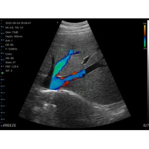 Linear/Convex/Phased Array 3 in 1 Handheld USB Ultrasound Double Probes Wireless