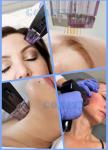 Morpheus8 Vertical 2 In 1 Fractional Radio Frequency Machine For Skin Tightening