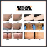 Laser Lipolysis Lipolaser Slimming Machine 6D 532nm 635nm 600W