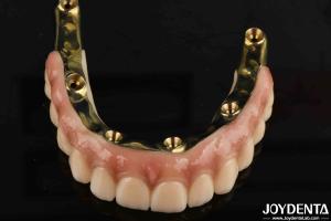 China Dental Prosthesis Ti-Bar Zirconia Hybrid Bridge With High Biocompatibility Standards factory