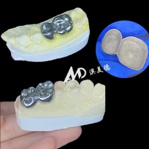 Metal Titanium Crown Precision Strength and Biocompatibility for Lasting