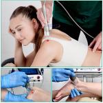 Focused Shockwave 1064nm Lllt Laser Therapy Physiotherapy Machine