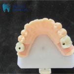 Steam Sterilization Single Implant Crown Smooth Surface Dental Implant Crown