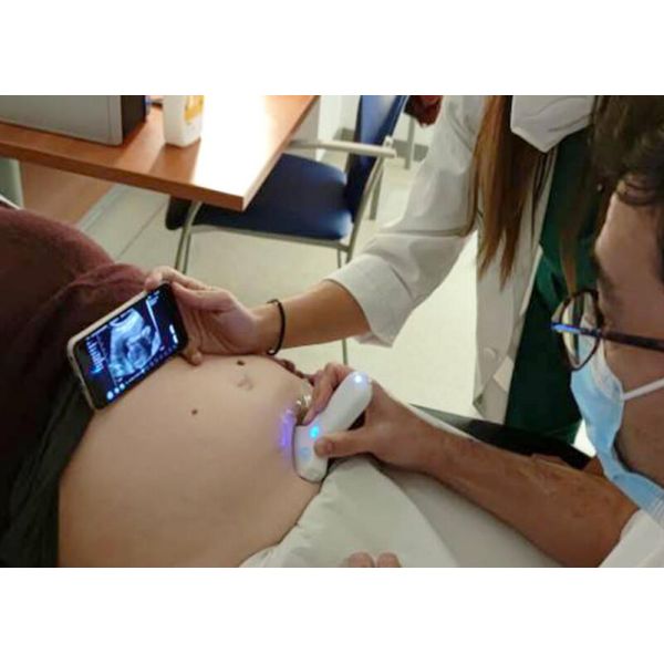 Ultrasound Scanner Phased Array Probe Portable Laptop Machine 2.2-3.6mhz 7.5/10mhz