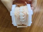 Natural Esthetics Layered Zirconia Crown Bridge For Beautiful Smile And Good