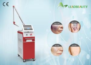 China 1064 nm 532nm Q Switch Nd Yag Laser Tattoo Removal Skin Treatment Machine factory