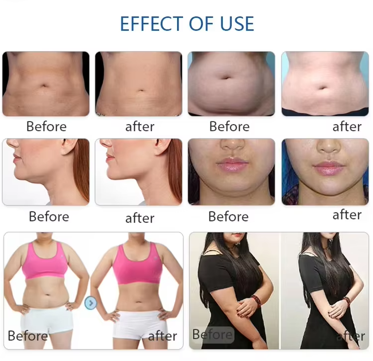 Fat Burning Rf Ems Body Shaper Four Way Four Control Device HI-EMT Machine