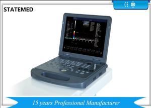 China Digital Portable Ultrasound Equipment / Small Ultrasound Machine 128 Elements factory