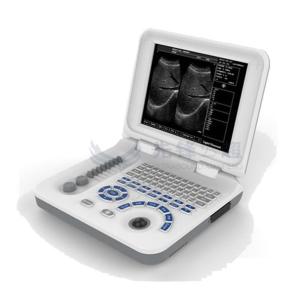 China OEM ODM Portable Ultrasound Machines For Home Use factory