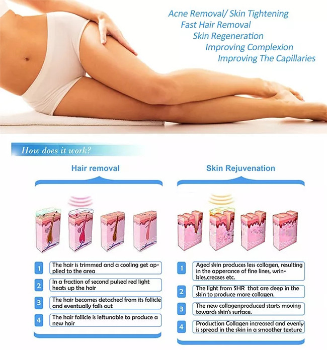 Blood Vessels IPL Hair Removal Machine 690nm Facial Hair Removal Laser Machine