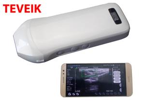 China Wireless USB Ultrasound Linear Probe Electric Protable Medical ultrasound instruments factory