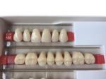 Acrylic Resin Denture Teeth Set Repair Surfaces 2 Layers Super Hard Synthetic
