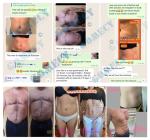 ABS Neo Slim Machine 5 Handle Electronic Muscle Sculpt Machine